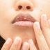 7 Homemade Remedies for Dry and Chapped Lips