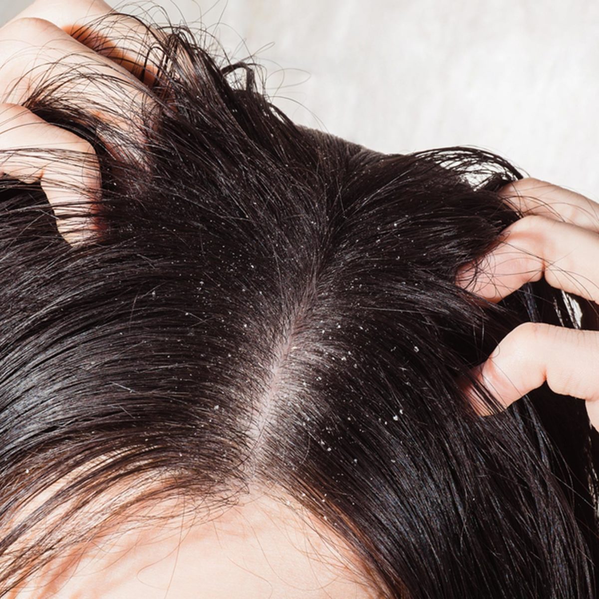 Greasy Hair Surprising Causes Behind Oily Locks Reader S