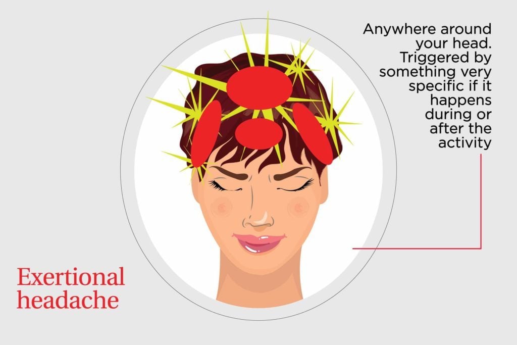 Types Of Headaches—and How To Get Rid Of Them Readers Digest