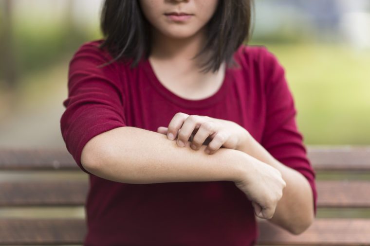 Woman Scratching Her Arm Sitting on Bench at Park