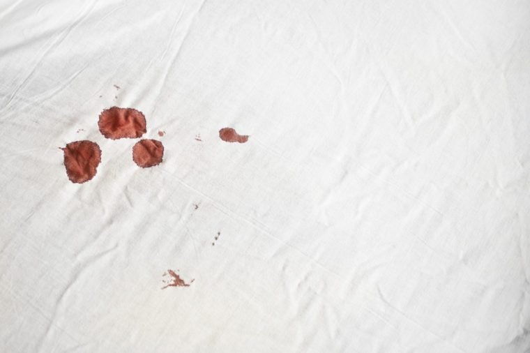 Bloodstains on a white sheet