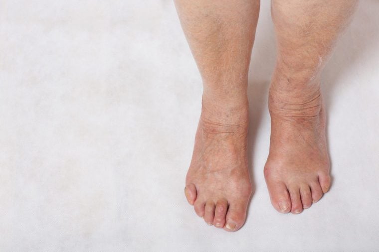 Feet of a senior woman between 70 and 80 years old