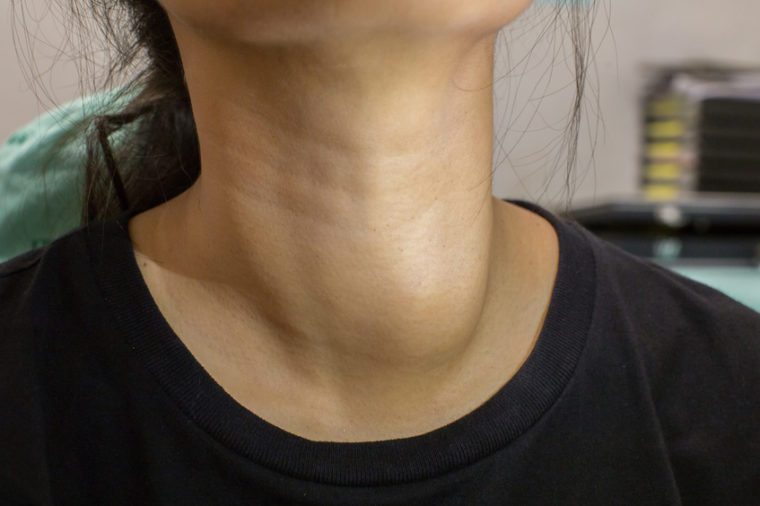 if-you-have-bumps-on-your-neck-here-s-what-it-could-mean-reader-s-digest