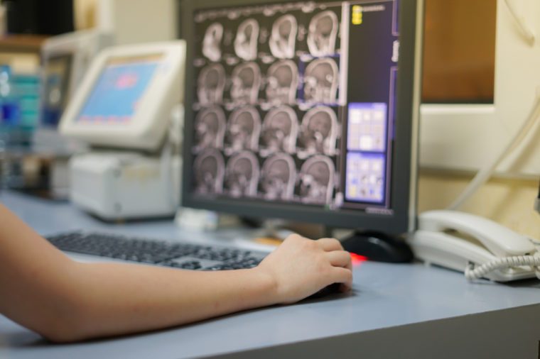 Radiotechnologist hand holding mouse while working on Magnetic Resonance Imaging(MRI) room workstation, Sagittal plane of MRI brain image is background, Medical concept