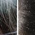 Here's How to Spot the Difference Between Lice and Dandruff
