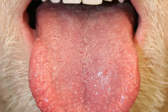 Bumps on the Tongue: What Could Mean | Reader's Digest