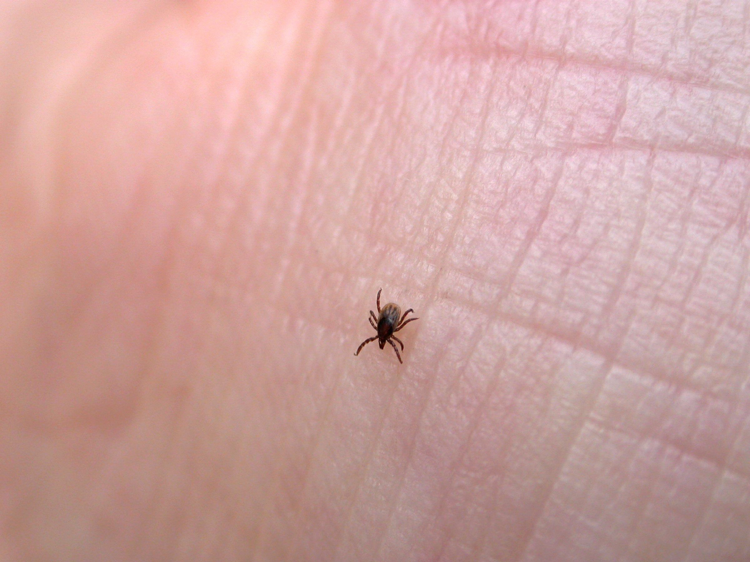 prevent-tick-bites-13-things-ticks-won-t-tell-you-reader-s-digest