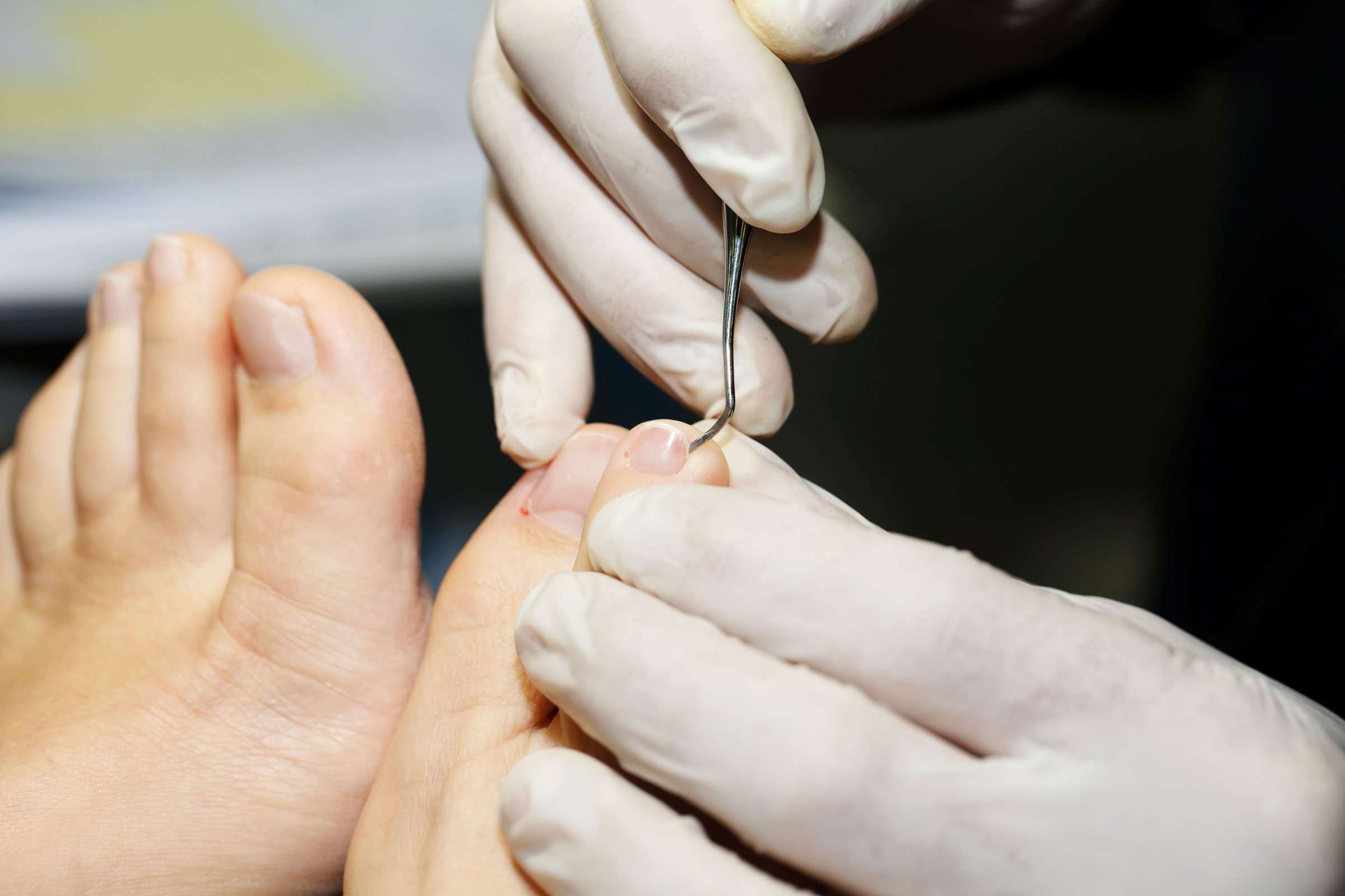 10 Signs of Disease Your Feet Can Reveal | Reader's Digest