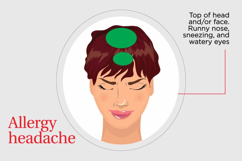 Sinus Pressure Top Of Head